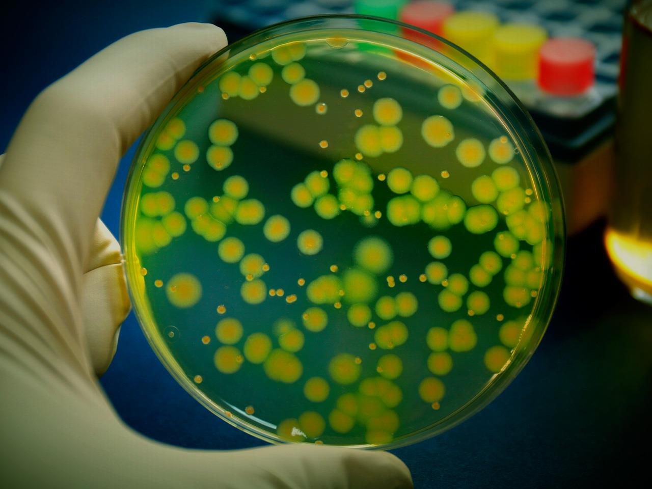 Селекция микроорганизмов фото