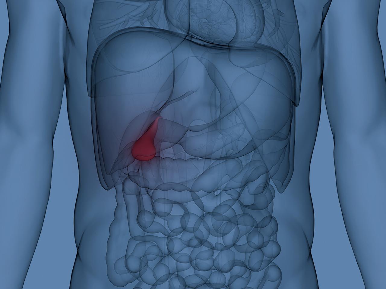 Inflamed Gallbladder
