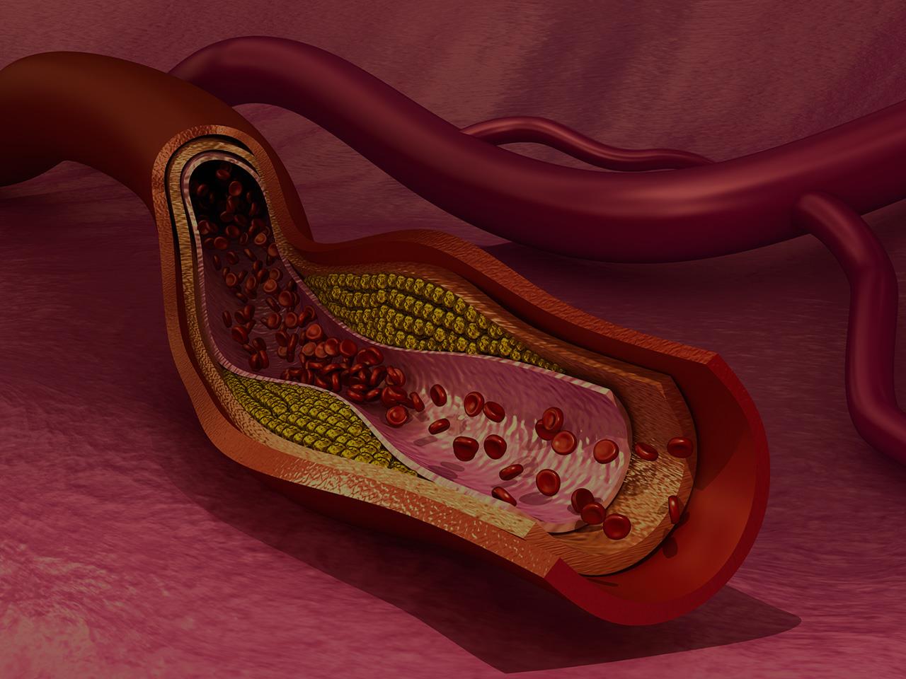 What Does High Lipase Mean at Clement Alvarez blog