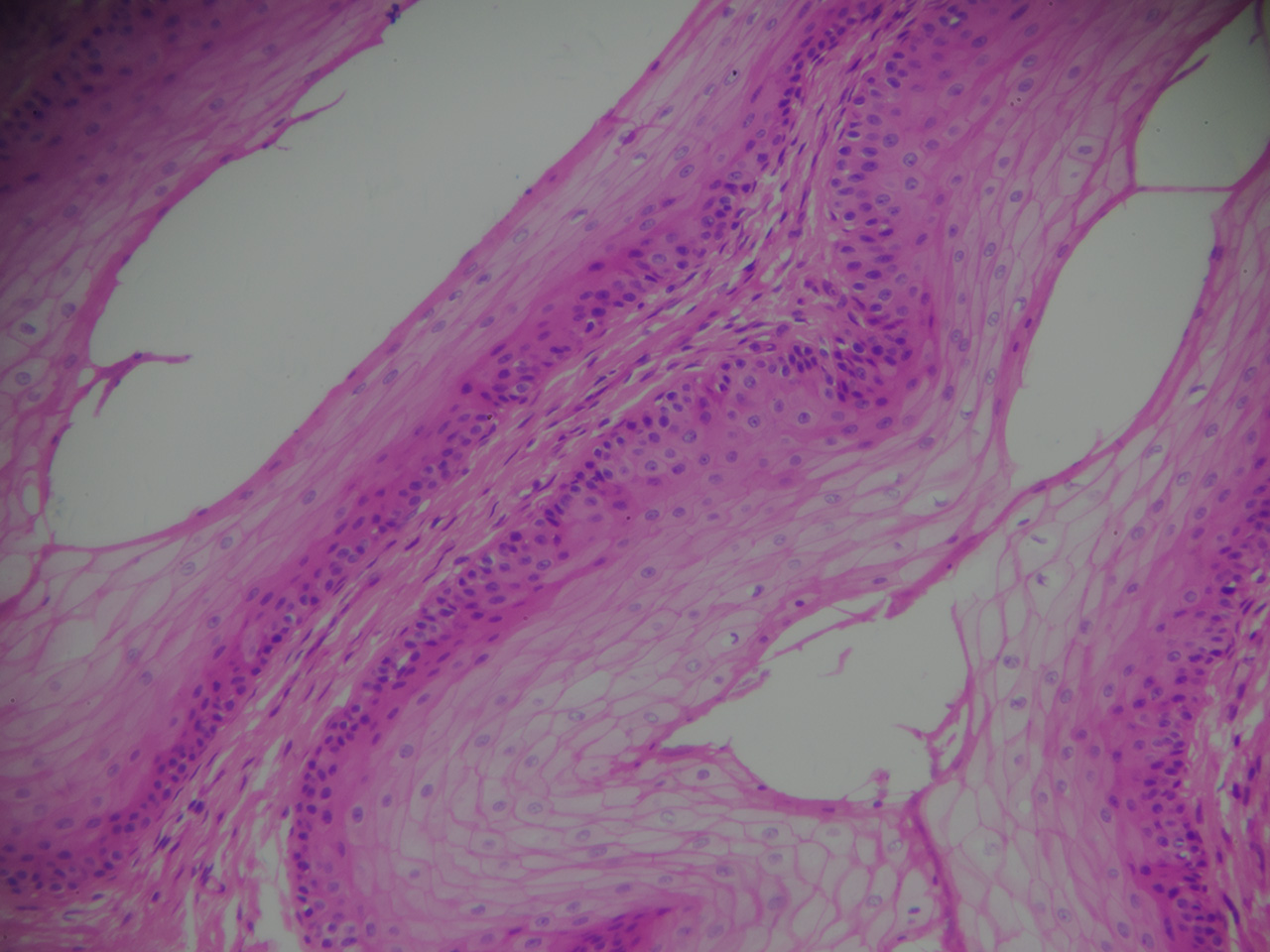 what-are-squamous-epithelial-cells